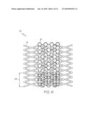 Closed-Cell Flexible Stent Hybrid diagram and image