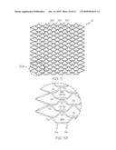 Closed-Cell Flexible Stent Hybrid diagram and image