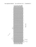 Closed-Cell Flexible Stent Hybrid diagram and image