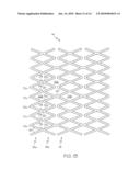 Closed-Cell Flexible Stent Hybrid diagram and image