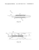 Closed-Cell Flexible Stent Hybrid diagram and image