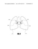 PERCUTANEOUS HEART VALVE WITH STENTLESS SUPPORT diagram and image