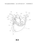 PERCUTANEOUS HEART VALVE WITH STENTLESS SUPPORT diagram and image