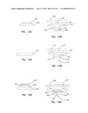 Small Volume In Vitro Sensor and Methods of Making diagram and image