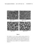 Plasma Separation Membrane diagram and image