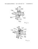 Seat Belt Retractor and Torsion Bar Providing Secondary Load Limiting diagram and image