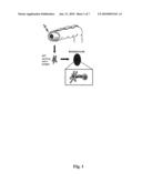 Composition Comprising In Vitro Expanded T-Lymphocytes and Vessel Formation Inhibitors Suitable in the Treatment of Cancer diagram and image