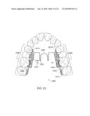 Orthodontic Devices diagram and image