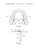 Orthodontic Devices diagram and image