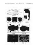 DIAGNOSTIC SCREENING METHODS FOR DISORDERS OF THE ENDOPLASMIC RETICULUM-TO-GOLGI TRAFFICKING OF PROTEINS diagram and image