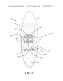 Solder Interconnect diagram and image