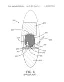 Solder Interconnect diagram and image