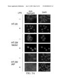 INTESTINAL ALKALINE PHOSPHATASE MODULATORS AND USES THEREOF diagram and image