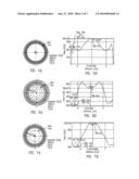 External Beam Radiotherapy And Imaging With Radioactive Isotope diagram and image