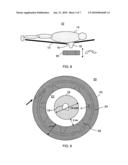 External Beam Radiotherapy And Imaging With Radioactive Isotope diagram and image