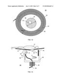 External Beam Radiotherapy And Imaging With Radioactive Isotope diagram and image