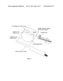 PROSTATE TREATMENT APPARATUS diagram and image