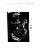 LOW-COST DEVICE FOR C-SCAN PHOTOACOUSTIC IMAGING diagram and image