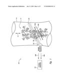 INTRALUMINAL FLUID PROPERTY STATUS SENSING SYSTEM AND METHOD diagram and image