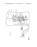 INTRALUMINAL FLUID PROPERTY STATUS SENSING SYSTEM AND METHOD diagram and image