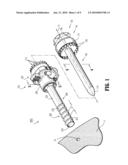 PORT FIXATION WITH INTERLOCKING STRUCTURE diagram and image