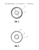 PORT FIXATION WITH INTERLOCKING STRUCTURE diagram and image