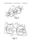 Devices for the Treatment of Vascular Aneurysm diagram and image