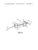 Devices for the Treatment of Vascular Aneurysm diagram and image