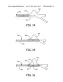 Devices for the Treatment of Vascular Aneurysm diagram and image