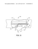 Devices for the Treatment of Vascular Aneurysm diagram and image