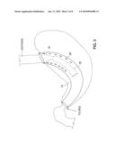 SATIATION DEVICES AND METHODS diagram and image