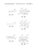 Small Volume In Vitro Sensor and Methods of Making diagram and image