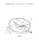 Anti-Back-Streaming Carburetor Valve diagram and image