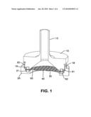 FLUID FILTER WITH POLYMERIC MEMBRANE AND METAL SUPPORTS diagram and image