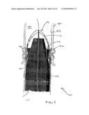 Vascular Anastomotic Staplers diagram and image