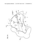 Airbag and airbag apparatus diagram and image