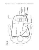 Airbag and airbag apparatus diagram and image