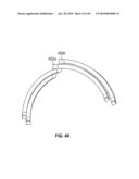 THERMALLY MATCHED COMPOSITE SLEEVE diagram and image