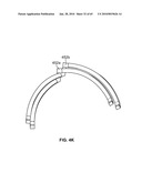 STATOR WEDGE FOR AN ELECTRIC MACHINE diagram and image