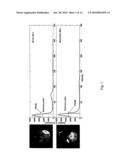 METHOD FOR IDENTIFYING A PATHOLOGICAL REGION OF A SCAN, SUCH AS AN ISCHEMIC STROKE REGION OF AN MRI SCAN diagram and image