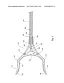 Pick up device with telescoping tube diagram and image