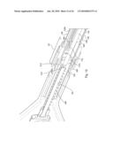 Pick up device with telescoping tube diagram and image