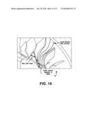 FLUID DEFLECTOR FOR FLUID SEPARATOR DEVICES diagram and image