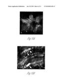 KIDNEY DERIVED STEM CELLS AND METHODS FOR THEIR ISOLATION, DIFFERENTIATION AND USE diagram and image