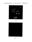 KIDNEY DERIVED STEM CELLS AND METHODS FOR THEIR ISOLATION, DIFFERENTIATION AND USE diagram and image