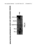 METHODS AND COMPOSITIONS FOR INHIBITING THE GROWTH OF HEMATOPOIETIC MALIGNANT CELLS diagram and image