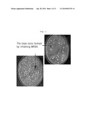 Bacillus Amyloliquefaciens K317 for Suppressing the Growth of Antibiotics-Resistant Pathogenic Microorganism or Enteropathogenic Microorganism diagram and image