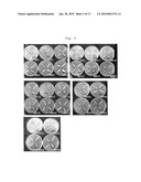 Bacillus Amyloliquefaciens K317 for Suppressing the Growth of Antibiotics-Resistant Pathogenic Microorganism or Enteropathogenic Microorganism diagram and image