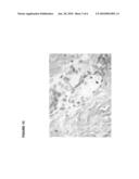 Modulators of SC4MOL for treating acne or hyperseborrhea diagram and image