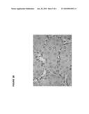 Modulators of SC4MOL for treating acne or hyperseborrhea diagram and image